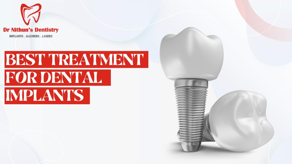 best dental implants in kompally