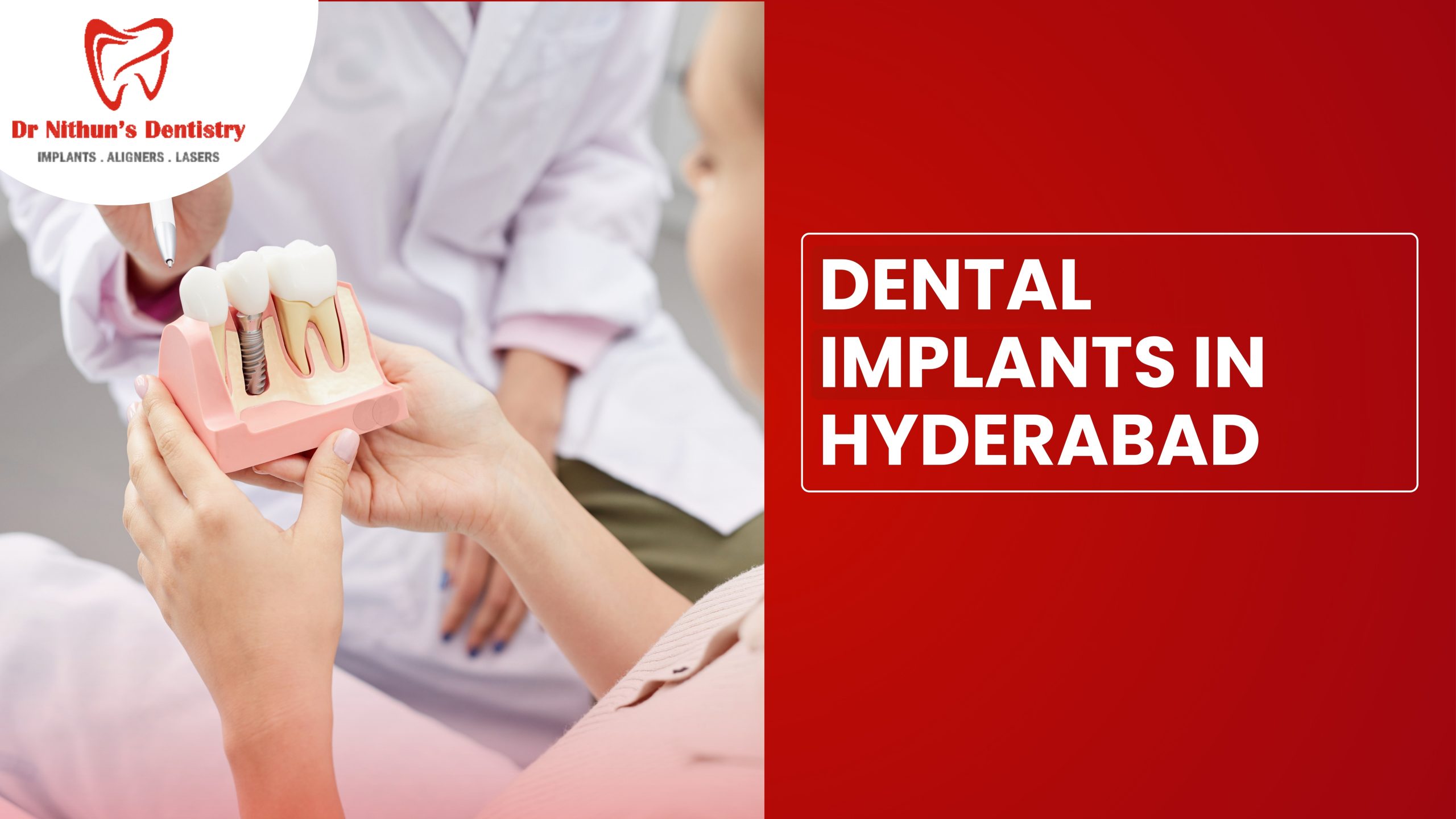 Affordable Dental Implants in Hyderabad: Budget Breakdown