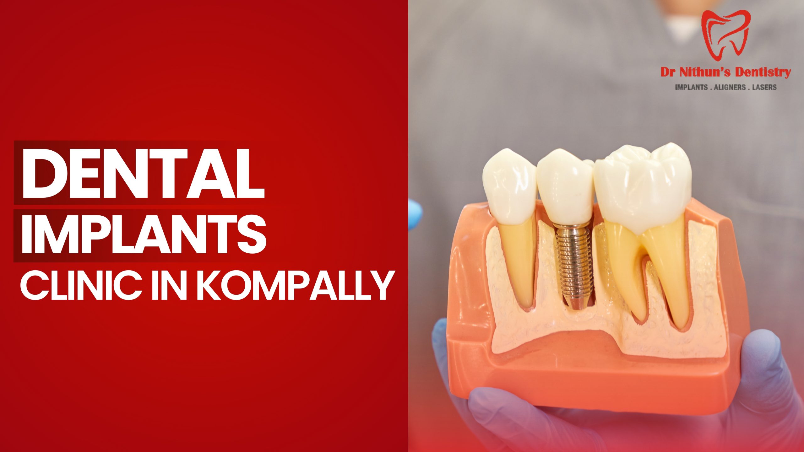 Best Dental Implants Clinic in Kompally: What Makes Nithun’s Dentistry Stand Out?