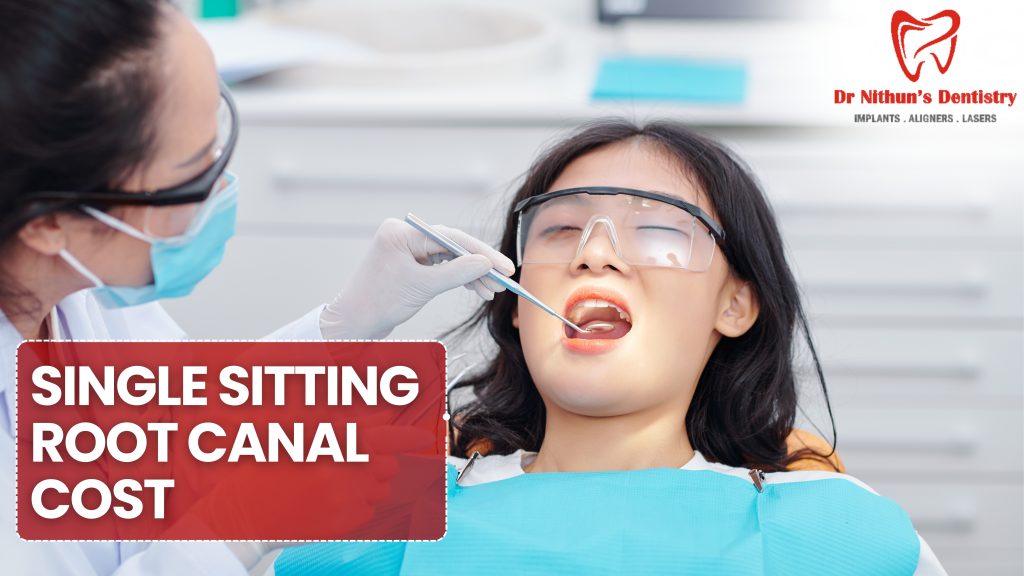 single sitting root canal