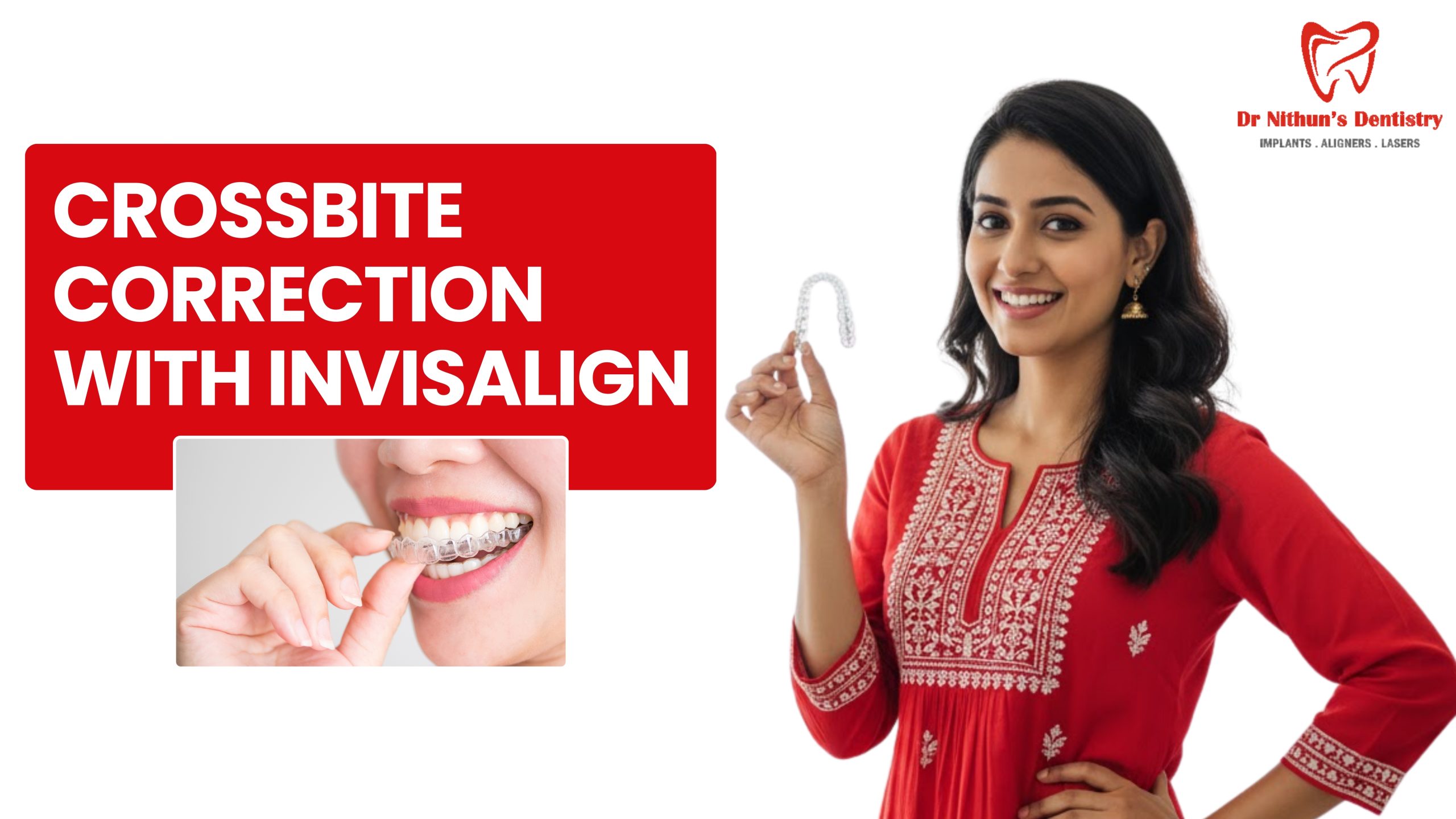 Crossbite Correction with Invisalign – A Clear Path to a Balanced Smile